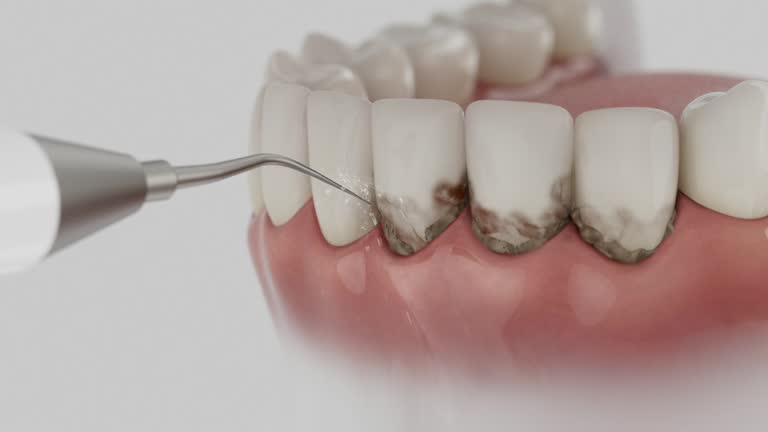Reliable Dental Implants contractor in Mission, OR by Smile Center Dentistry
